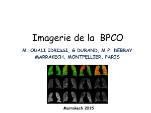 Imagerie BPCO