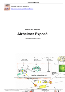 Alzheimer Exposé