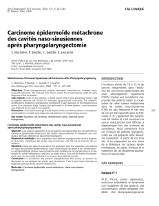 Carcinome épidermoïde métachrone des cavités naso