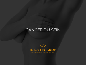 Pour consulter la présentation du Dr Haddad sur le cancer du sein