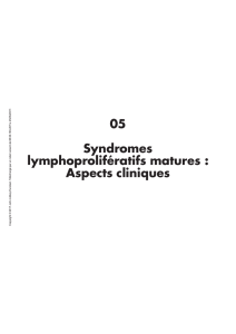 05 Syndromes lymphoprolifératifs matures : Aspects cliniques