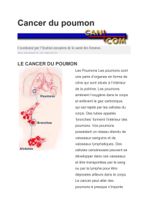 Cancer du poumon - European Institute of Women`s Health