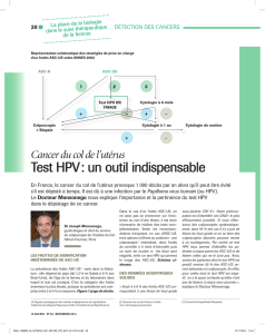 Test HPV : un outil indispensable
