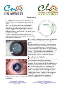 La cataracte - Centre Narbonnais d`Ophtalmologie