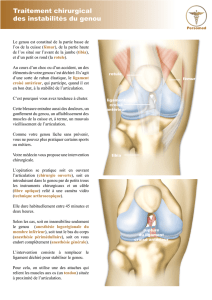 Traitement chirurgical des instabilités du genou