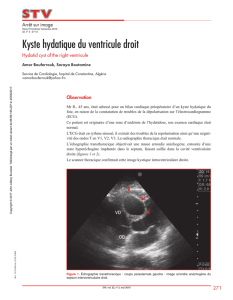 Kyste hydatique du ventricule droit