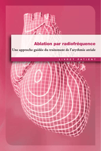 Ablation par radiofréquence