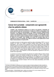Cancer de la prostate : comprendre son agressivité chez les patients