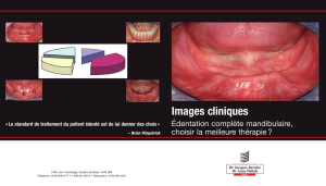 Images cliniques - Implants Québec