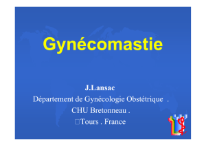 Gynécomastie