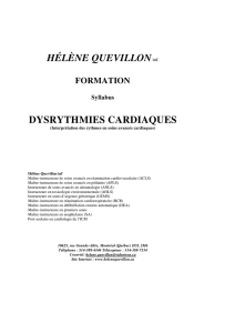 Dysrythmies cardiaques - Hélène Quevillon Formation
