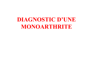 monoarthrite