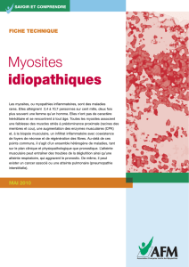 Les myosites idiopathiques