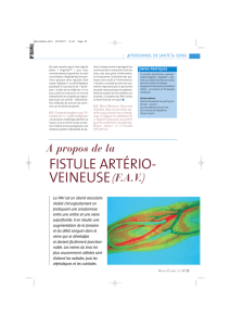 fistule artério- veineuse - Rein