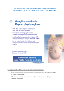 La biopsie du Ganglion sentinelle photos peroperatoire