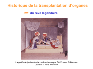 Historique de la transplantation d`organes