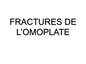 les fractures du col de l`omoplate