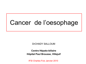 Cancer de l`oesophage - IFSI Charles-Foix