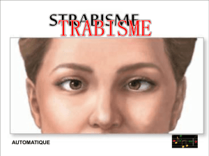 Estrabismo - Diaporamas a la con