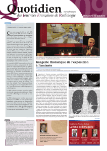 Dimanche Quotidien JFR09.indd - Société Française de Radiologie