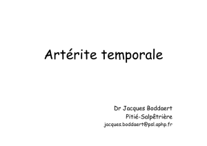 Artérite temporale (Dr. J. Boddaert)