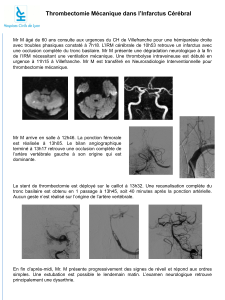 Thrombectomie Mécanique dans l`Infarctus Cérébral - nri
