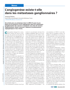 L`angiogenèse existe-t-elle dans les métastases ganglionnaires ?