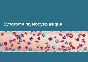 Syndrome myélodysplasique - Cabinet Médical Dr. Jérôme Voegeli