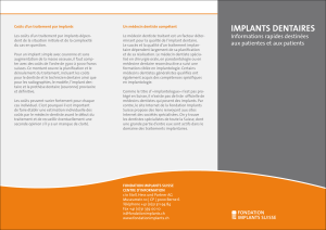 implants dentaires