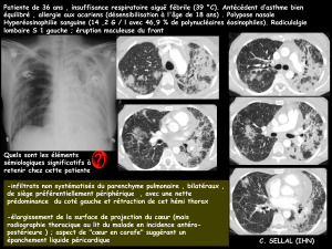 Patiente de 36 ans , insuffisance respiratoire aiguë fébrile (39 °C