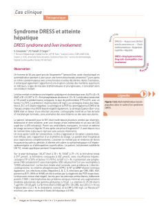 Syndrome DRESS et atteinte hépatique Cas clinique DRESS syndrome and liver involvement