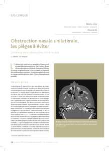 L’ Obstruction nasale unilatérale, les pièges à éviter CAS CLINIQUE