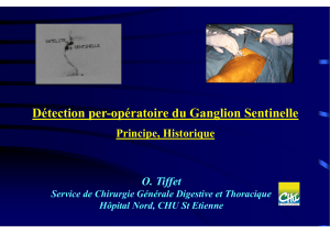 Détection per-opératoire du Ganglion Sentinelle Principe, Historique O. Tiffet