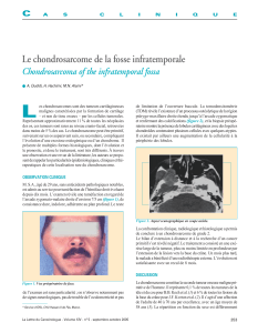 L Le chondrosarcome de la fosse infratemporale Chondrosarcoma of the infratemporal fossa C