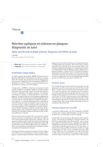 Névrites optiques et sclérose en plaques : diagnostic et suivi Focus