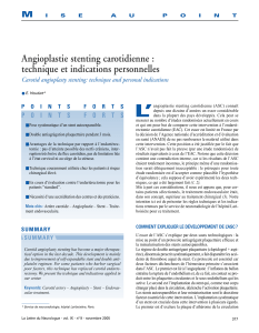 L’ Angioplastie stenting carotidienne : technique et indications personnelles M