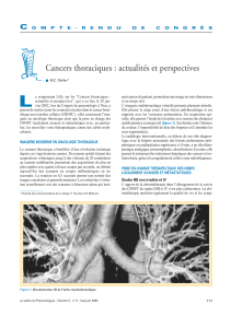 Cancers thoraciques : actualités et perspectives C