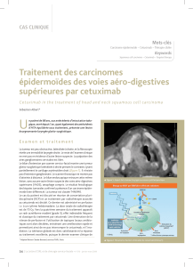 U Traitement des carcinomes épidermoïdes des voies aéro-digestives supérieures par cetuximab