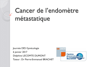 Cancer de l’endomètre métastatique Journée DES Gynécologie 6 janvier 2017