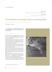 Thrombose coronaire chez un hémophile N CAS CLINIQUE Mots-clés
