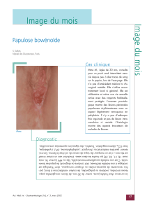 Image du mois Papulose bowénoïde Cas clinique