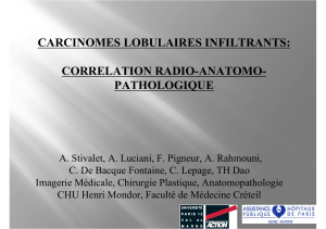 CARCINOMES LOBULAIRES INFILTRANTS: CORRELATION RADIO-ANATOMO- PATHOLOGIQUE