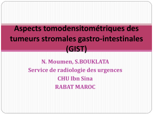 Aspects tomodensitométriques des tumeurs stromales gastro-intestinales (GIST)