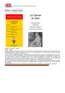 CD-Rom : Le Cancer du Sein