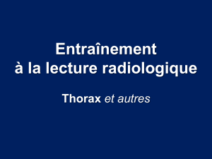 Entraînement à la lecture radiologique  Thorax