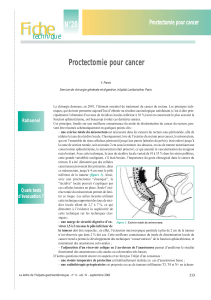 Fiche N°20 Proctectomie pour cancer technique