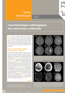 73 n° L Caractéristiques radiologiques