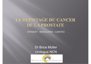 Dr Brice Müller Urologue NCN INTERET - MODALITES - LIMITES