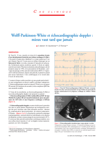 Wolff-Parkinson-White et échocardiographie doppler : mieux vaut tard que jamais C