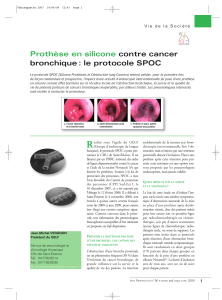 Prothèse en silicone contre cancer bronchique : le protocole SPOC